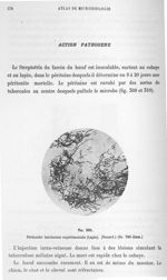 Fig. 309. Péritonite farcineuse expérimentale (lapin) (Nocard) (gr. 700 diam.). - Atlas de microbiol [...]