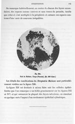 Fig. 321. Pied de Madura. Coupe (Vincent) (gr. 500 diam.). - Atlas de microbiologie par E. Doyen et  [...]
