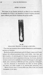 Fig. 333. Culture de sacch. Ellipsoïdeus I sur agar-agar au moût de bière. - Atlas de microbiologie  [...]