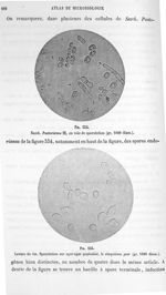 Fig. 334. Sacch. Pastorianus III, en voie de sporulation (gr. 1000 diam.) / Fig. 335. Levure de vin. [...]