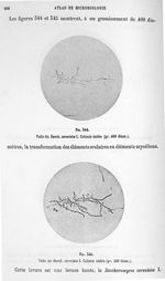 Fig. 344. Voile du sacch. cerevisiae I. Colonie isolée (gr. 400 diam.) / Fig. 345. Voile du sacch. c [...]