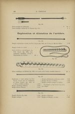 Fig. 633. - Porte-caustique uréthral du Dr Pousson / Fig. 634. - Bougie exploratrice à boule, du Pro [...]