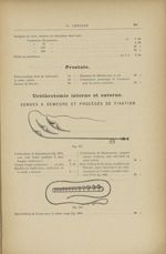 Fig. 667. - Uréthrotome de Maisonneuve / Fig. 668. - Série d'olives de Guyon - Catalogue illustrée.  [...]