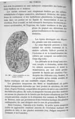 Fig. 269. Kyste congénital du rein d'après Virchow. - Manuel d'histologie pathologique, par V. Corni [...]