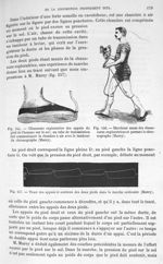 Fig. 155. Chaussure exploratrice des appuis du pied de l'homme sur le sol/ Fig. 156. Marcheur muni d [...]