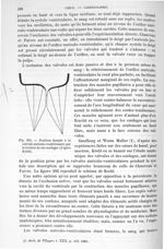 Fig. 291. Position donnée à la valvule auriculo-ventriculaire par la tension de ses cordages - Trait [...]