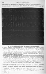 Fig. 310. Cardiographie typique sur un sujet en état physiologique - Traité de physique biologique.  [...]
