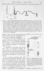 Fig. 333. Schéma explicatif du manomètre Hg inscripteur de Chauveau/ Fig. 334. Sphygmoscope de Chauv [...]