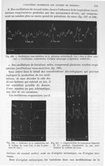 Fig. 349. Oscillations vaso-motrices de la pression (...) chez le chien curarisé / Fig. 350. Influen [...]