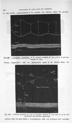 Fig. 389. Variations corrélatives de la pression artérielle et de la pression veineuse/ Fig. 390. Pr [...]