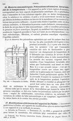Fig. 436. Osmomètre de Pfeffer - Traité de physique biologique. Tome premier