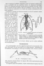 Fig. 489. Mesure de l'élasticité pulmonaire par la pression intrathoracique/ Fig. 490. Pneumographe  [...]