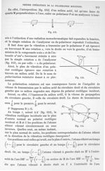 Fig. 112 à 114 - Traité de physique biologique. Tome deuxième