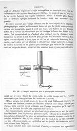 Fig. 226. Lampe à magnésium pour la photographie endoscopique. - Traité de physique biologique. Tome [...]