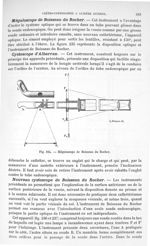 Fig. 235. Mégaloscope de Boisseau du Rocher. - Traité de physique biologique. Tome deuxième