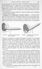 Fig. 238. Cystoscope de Leiter/ Fig. 239. Cystoscope de Leiter. - Traité de physique biologique. Tom [...]