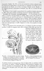 Fig. 246. La tête est droite/ Fig. 247. Image laryngoscopique correspondant à la Fig. 246. - Traité  [...]