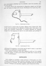 Fig. 274. Hystéroscope de Clado/ Fig. 275. Hystéroscope de Clado. - Traité de physique biologique. T [...]
