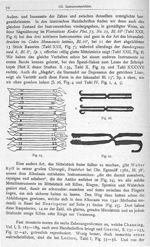 Fig. 25. Zahnsteinschaber des Baseler Druckes (1541) / Fig. 26. Zahnzangen der Inkunabel / Fig. 27.  [...]