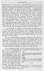 Fig. 28. Zahnzangen des raseler Druckes von 1541. - Beiträge zur Geschichte der Chirurgie im Mittela [...]