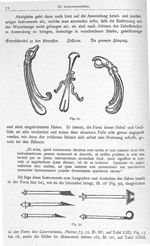 Fig. 29. Zahnzangen und pelikan des W. H. Ryff / Fig. 30. Scharfe Zahnwurzelhebel der Inkunabel. - B [...]