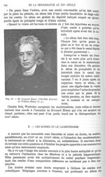 Fig. 40. Sir Everand Home, 1763-1832 -  Encyclopédie française d'urologie, publiée sous la direction [...]