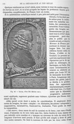 Fig. 46. Daran, 1701-1784 -  Encyclopédie française d'urologie, publiée sous la direction de MM. A.  [...]