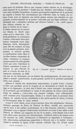 Fig. 50. Morgagni, 1682-1771 -  Encyclopédie française d'urologie, publiée sous la direction de MM.  [...]