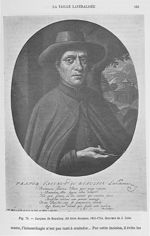 Fig. 79. Jacques de Beaulieu, dit frère jacques, 1651-1714 -  Encyclopédie française d'urologie, pub [...]