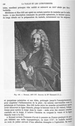 Fig. 103.  Morand, 1697-1767 -  Encyclopédie française d'urologie, publiée sous la direction de MM.  [...]