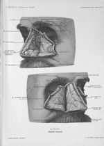 Planche 6. Région nasale - Précis-atlas de dissection des régions