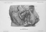 Planche 13. Fosse ptérygo-maxillaire - Précis-atlas de dissection des régions