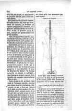 Figure de la Cannule - Oeuvres complètes d'Ambroise Paré, revues et collationnées sur toutes les édi [...]