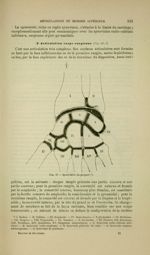 Fig. 45 - Synoviales du poignet - Nouveaux éléments d'anatomie descriptive et d'embryologie