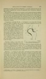 Fig. 52 - Coupe transversale et verticale de l'articulation coxo-fémorale - Nouveaux éléments d'anat [...]