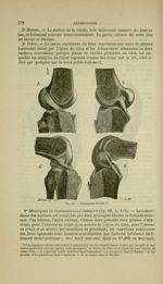 Fig. 54 - Ligaments croisés - Nouveaux éléments d'anatomie descriptive et d'embryologie