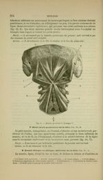 Fig. 64 - Muscles profonds de la nuque - Nouveaux éléments d'anatomie descriptive et d'embryologie