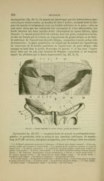 Fig. 69 - Canal inguinal et canal crural : partie profonde - Nouveaux éléments d'anatomie descriptiv [...]
