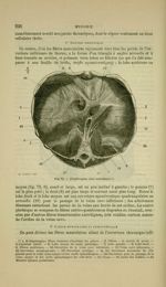 Fig. 73 - Diaphragme, face inférieure - Nouveaux éléments d'anatomie descriptive et d'embryologie