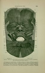 Fig. 80 - Muscles de la face disséqués en conservant leurs insertions cutanées et en sacrifiant leur [...]
