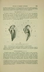Fig. 84 - Muscles sus-épineux, vue d'en haut - Nouveaux éléments d'anatomie descriptive et d'embryol [...]
