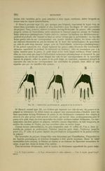 Fig. 96 - Synoviales antérieures du poignet et de la main - Nouveaux éléments d'anatomie descriptive [...]