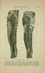Fig. 100 - Muscles postérieurs de la cuisse - Nouveaux éléments d'anatomie descriptive et d'embryolo [...]
