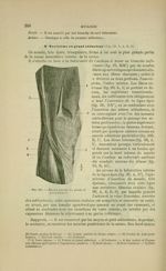 Fig. 101 - Région interne du genou et patte d'oie - Nouveaux éléments d'anatomie descriptive et d'em [...]