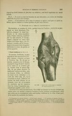Fig. 102 - Synoviales tendineuses et tendons du creux proplite - Nouveaux éléments d'anatomie descri [...]