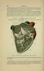 Fig. 115 - Surface interne de l'oreillette et du ventricule droits - Nouveaux éléments d'anatomie de [...]