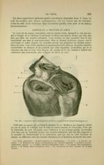 Fig. 118 - Anneaux fibro-cartilagineux auriculo-ventriculaires (d'après Parchappe) - Nouveaux élémen [...]