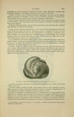 Fig. 120 - Tourbillon de la pointe du coeur (d'après Bourgery) - Nouveaux éléments d'anatomie descri [...]