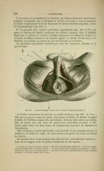 Fig. Artère honteuse interne chez l'homme (région périnéale) - Nouveaux éléments d'anatomie descript [...]