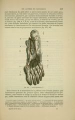 Fig. 160 - Arcade plantaire - Nouveaux éléments d'anatomie descriptive et d'embryologie